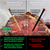 MeatStick V Set